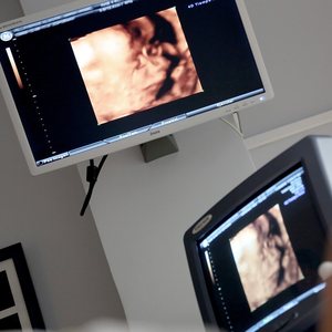 An ultrasound scan on screen during a check-up